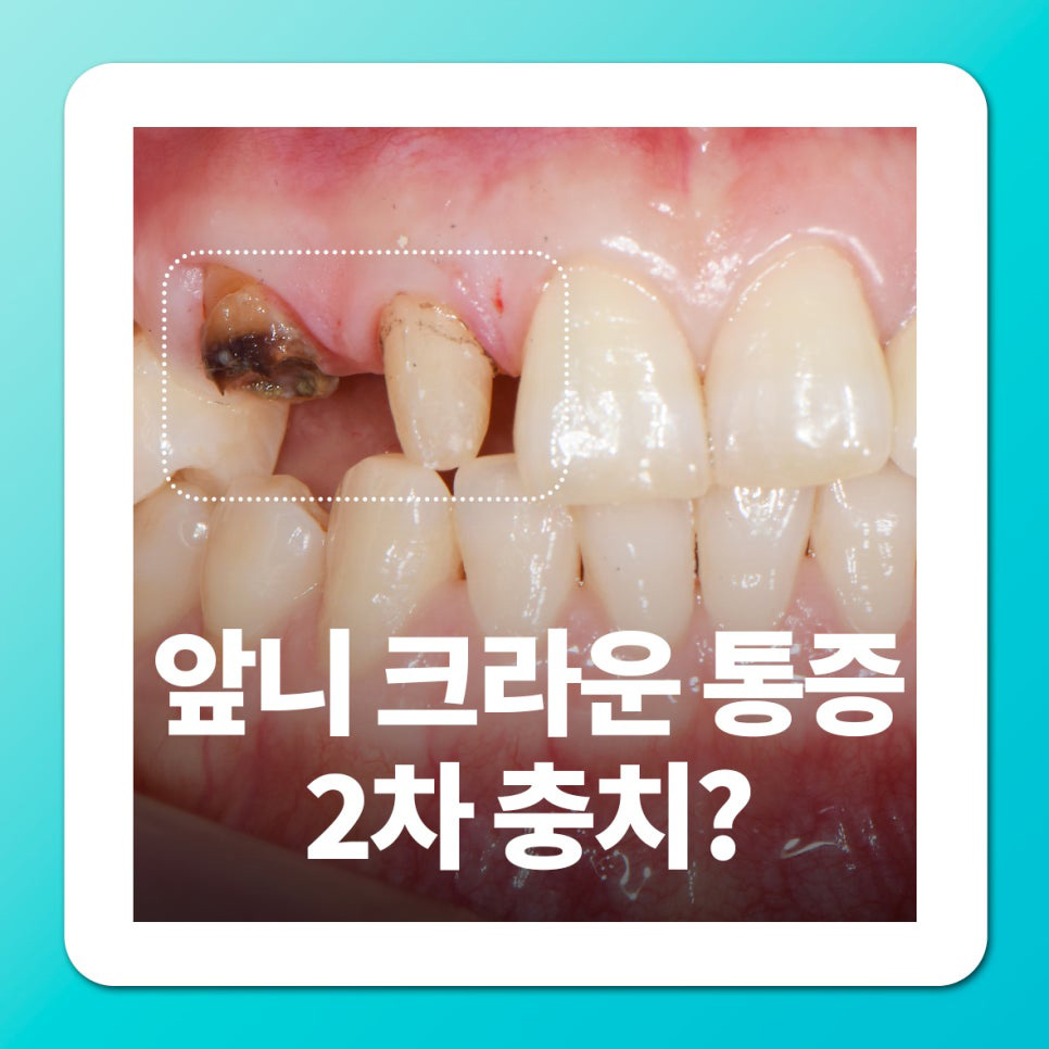 2d8f69e2b5383.jpg