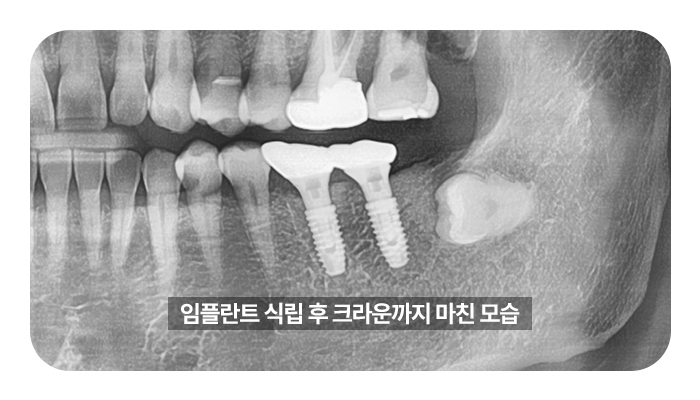 67b49e11709ae.jpg