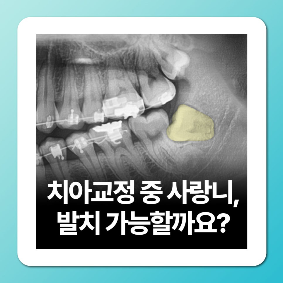 7a56af3d648d8.jpg