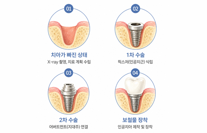 d12ea292ad6eb.jpg
