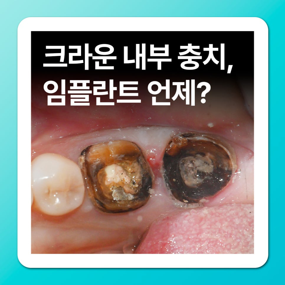 f8872c6fff49f.jpg