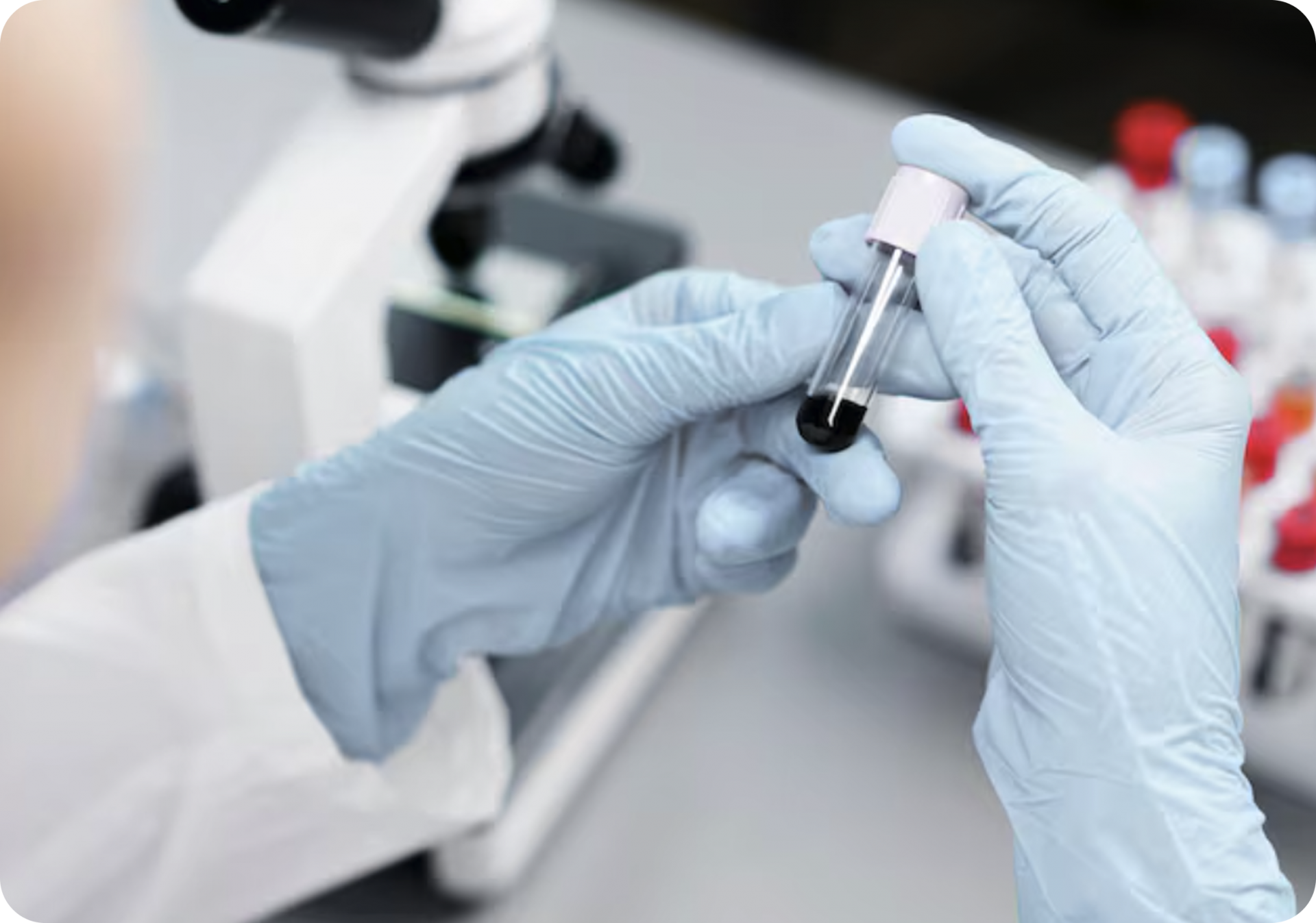 자체 조직은행 보유