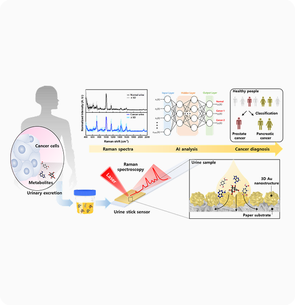 암 선별 검사 프로세스