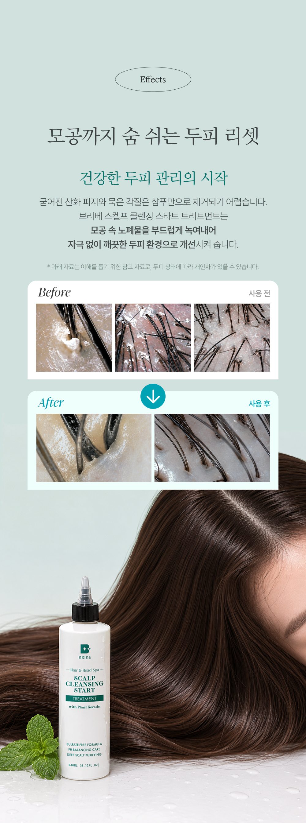 스켈프 클렌징 스타트 트리트먼트 (240ml/1000ml)