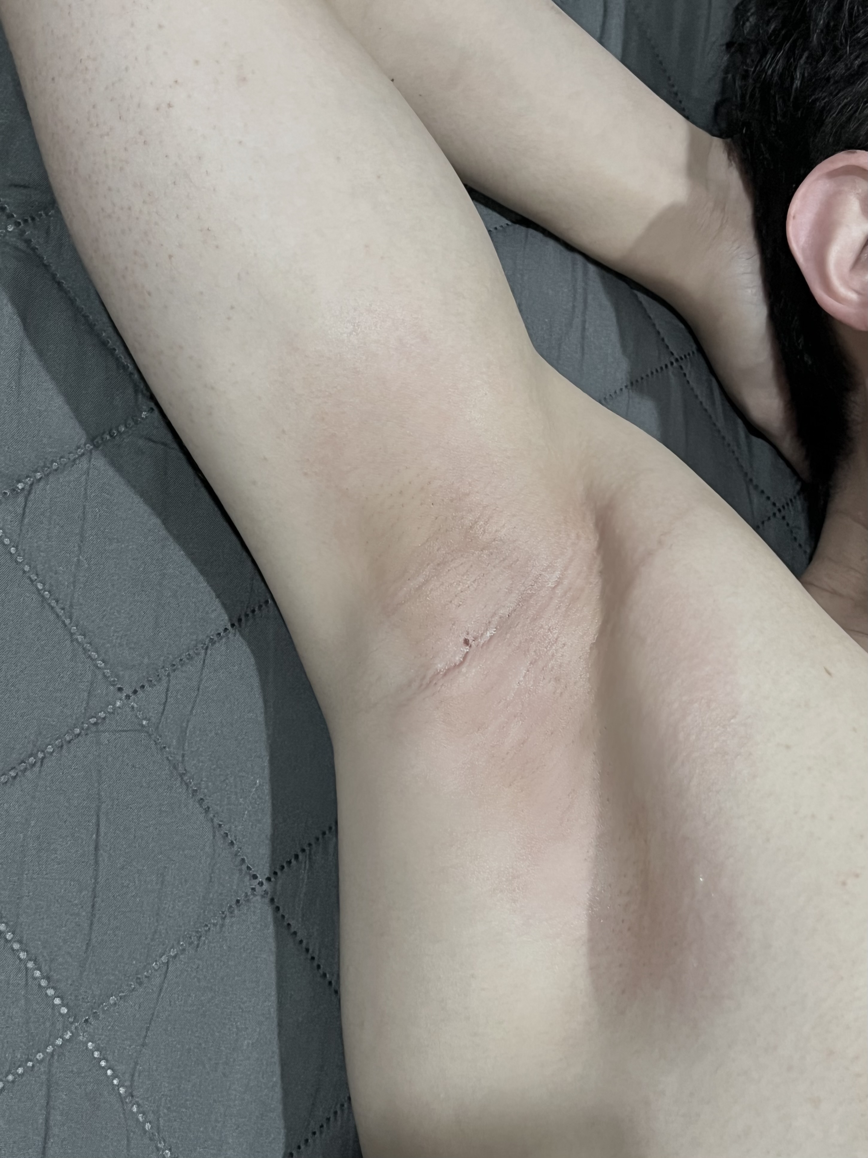 운동 할때 겨드랑이 털이 거슬려서 왁싱을 시작해보려고 ...