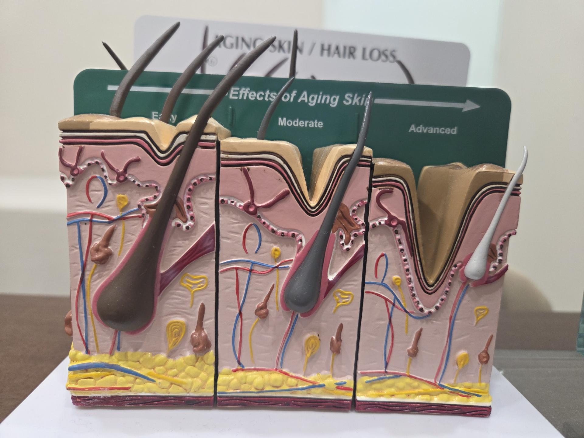 81abf5254a45a.jpg