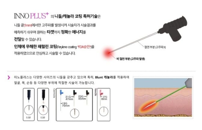 [닥터스앱] 이노플러스(INNO PLUS)