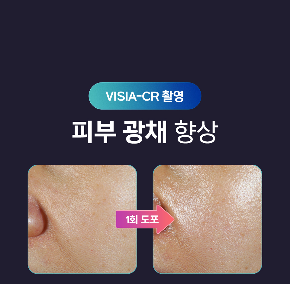 [셀레베 X 셀러브리티][~7.19 앵콜🔔] 셀러브리티 핫딜! 글로우캐비어 PDRN 최대 69% 할인