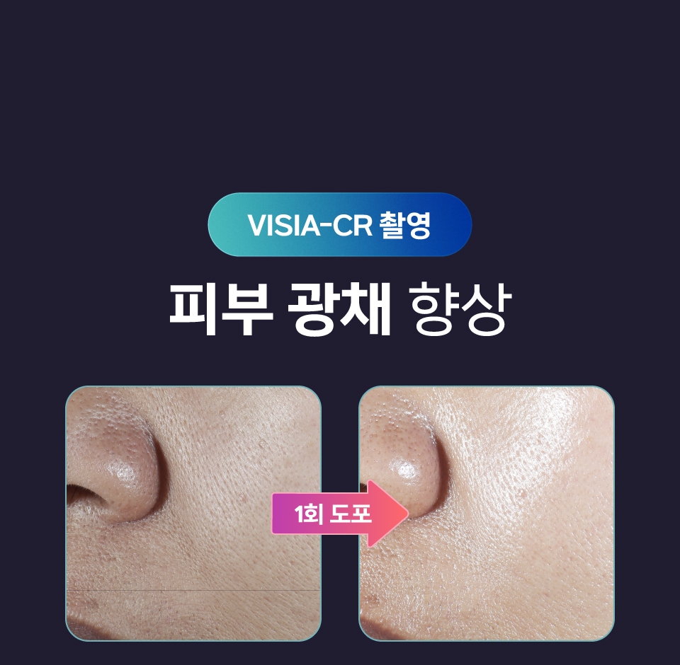 [셀레베 X 셀러브리티][~7.19 앵콜🔔] 셀러브리티 핫딜! 글로우캐비어 PDRN 최대 69% 할인