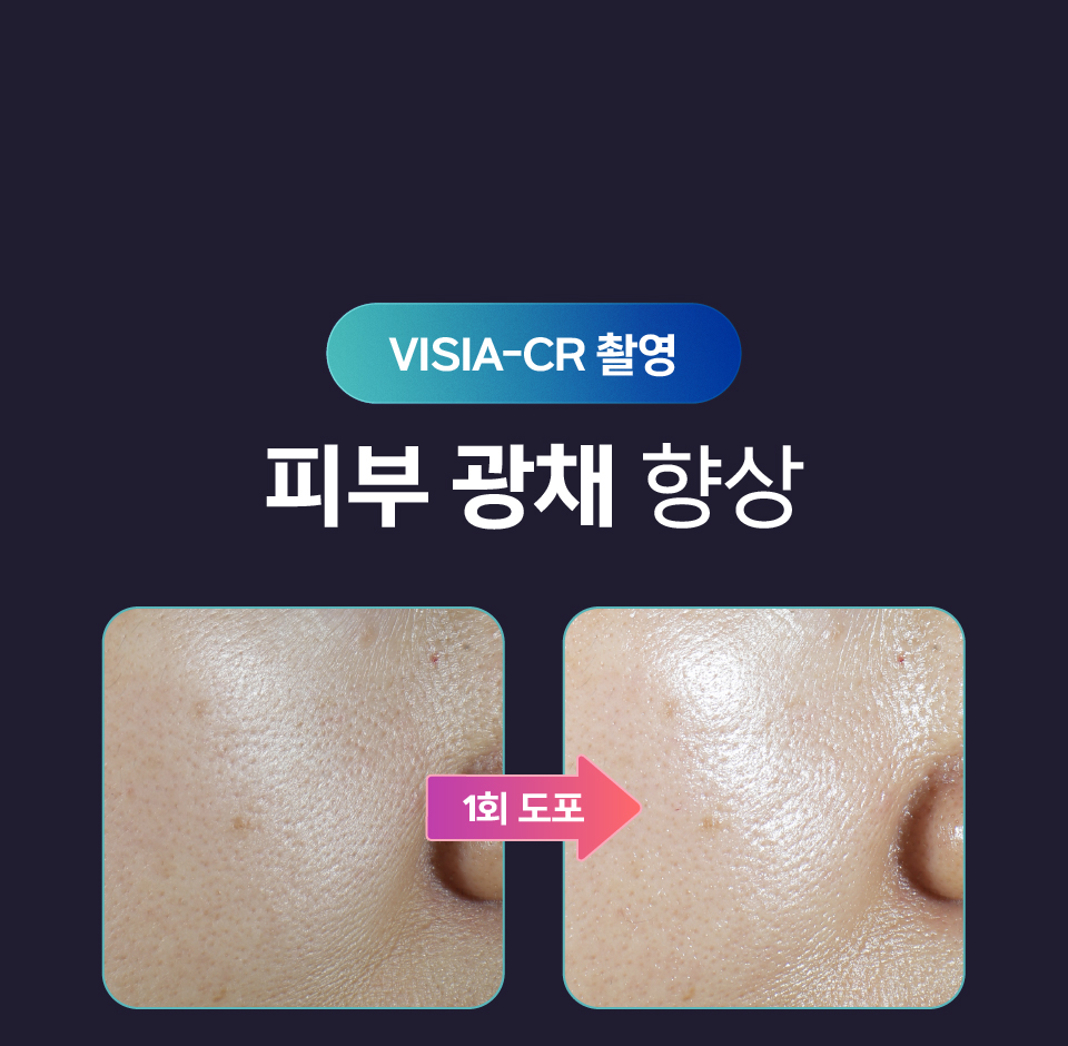 [셀레베 X 셀러브리티][~7.19 앵콜🔔] 셀러브리티 핫딜! 글로우캐비어 PDRN 최대 69% 할인