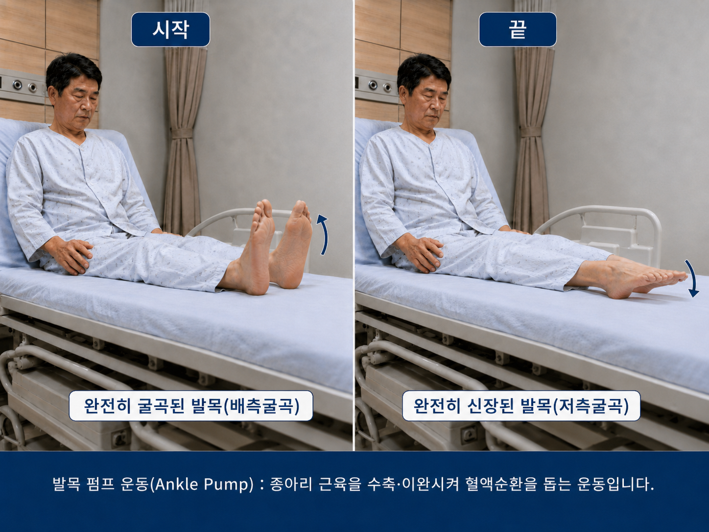 전립선암 수술 후 재활운동 발목 펌프운동