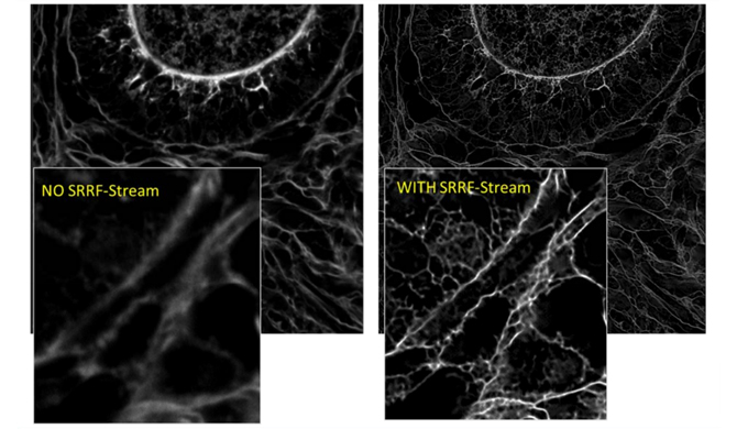 With vs Without SRRF-Stream