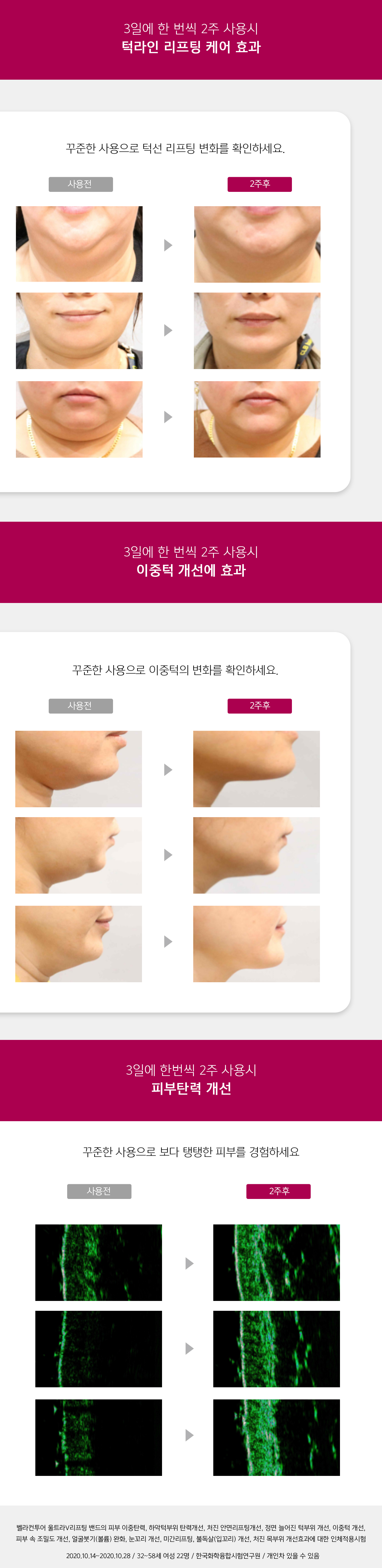 벨라컨투어 울트라 V 리프팅 밴드 윤곽관리 얼굴 타이트닝