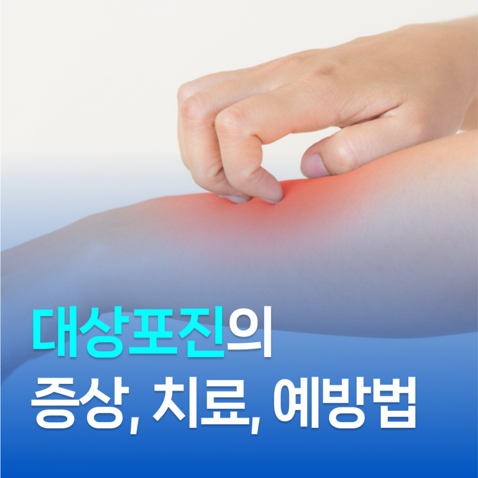 12ca70a88a1a8.png