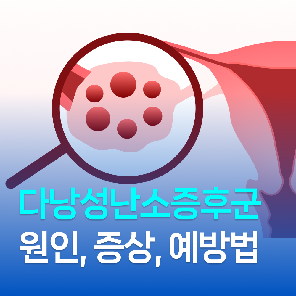 2e2934b955646.png