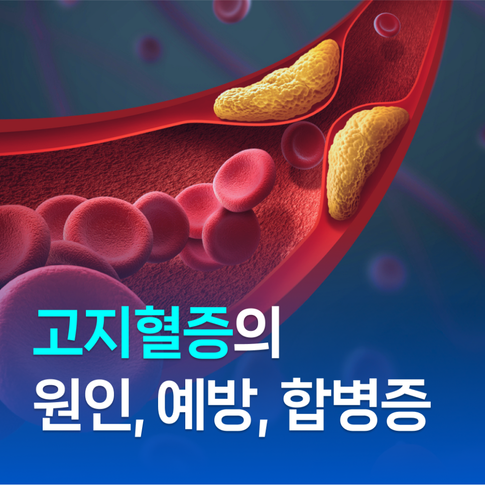 6189359370eb1.png