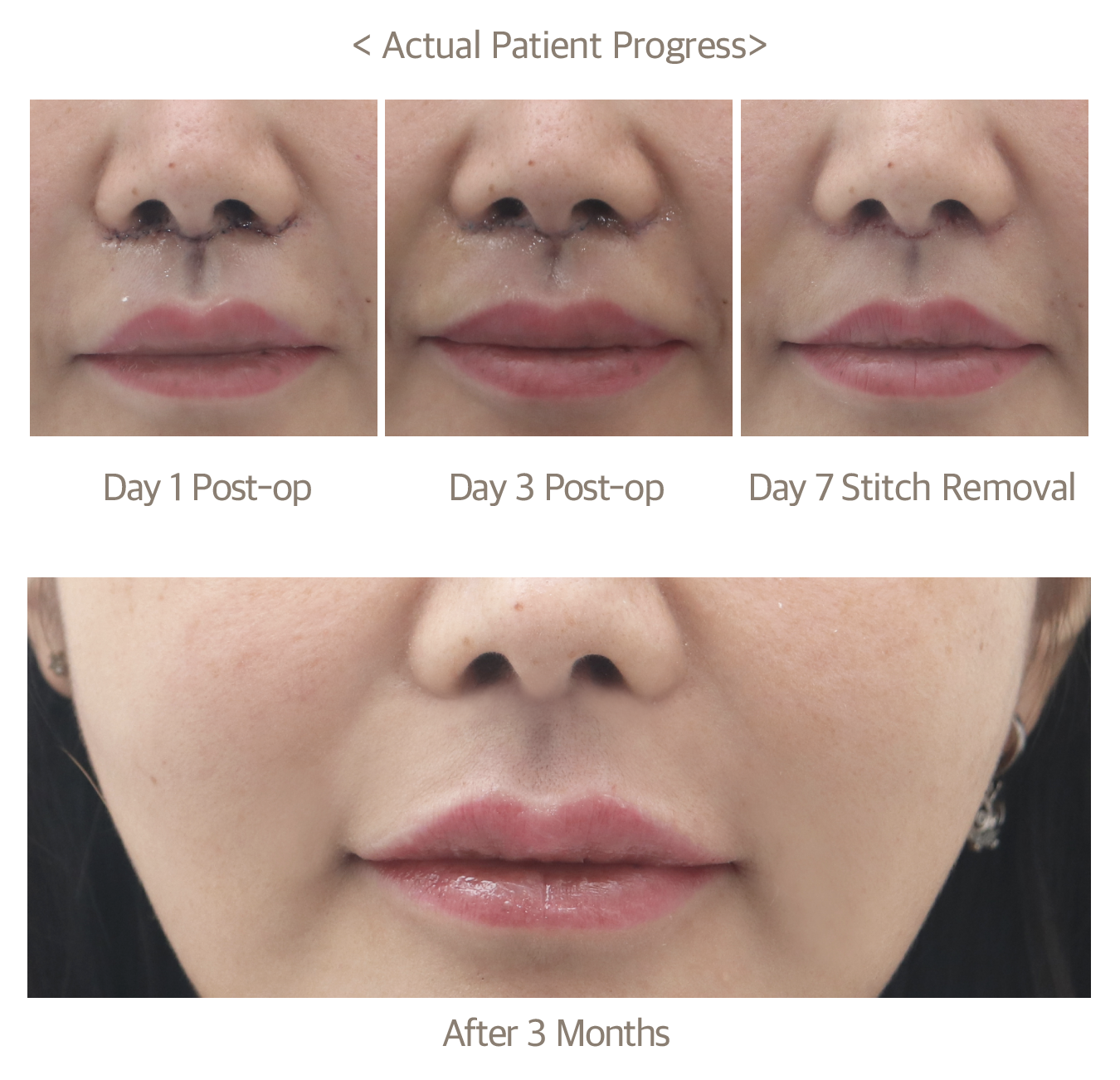 Patient progress