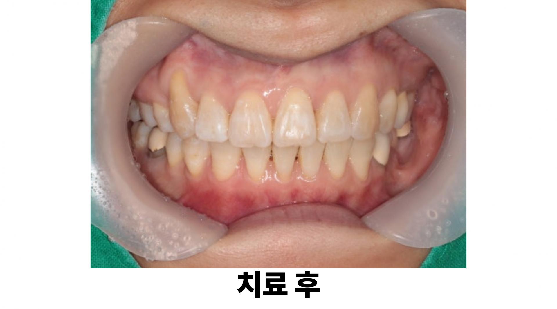 045348bf7efee.jpg