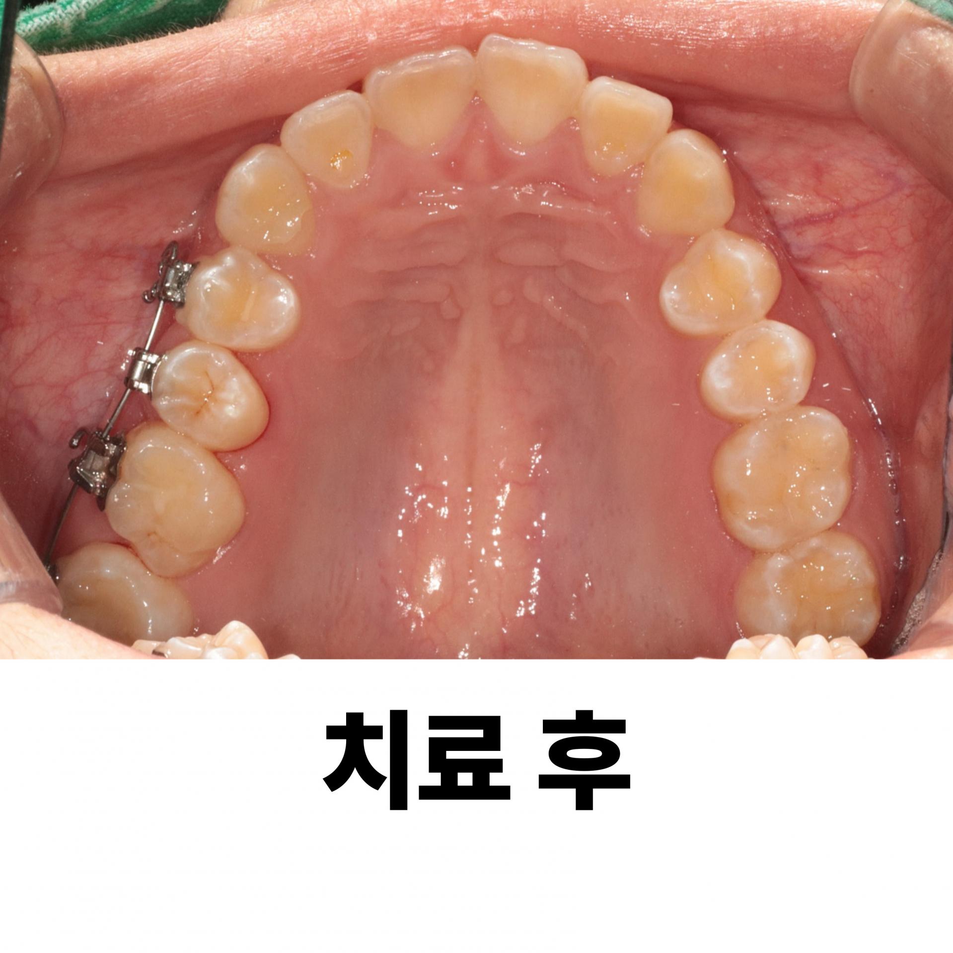 56383bbd44098.jpg