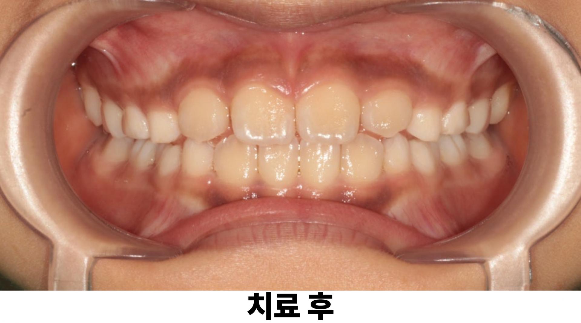 577f5b4ab4635.jpg