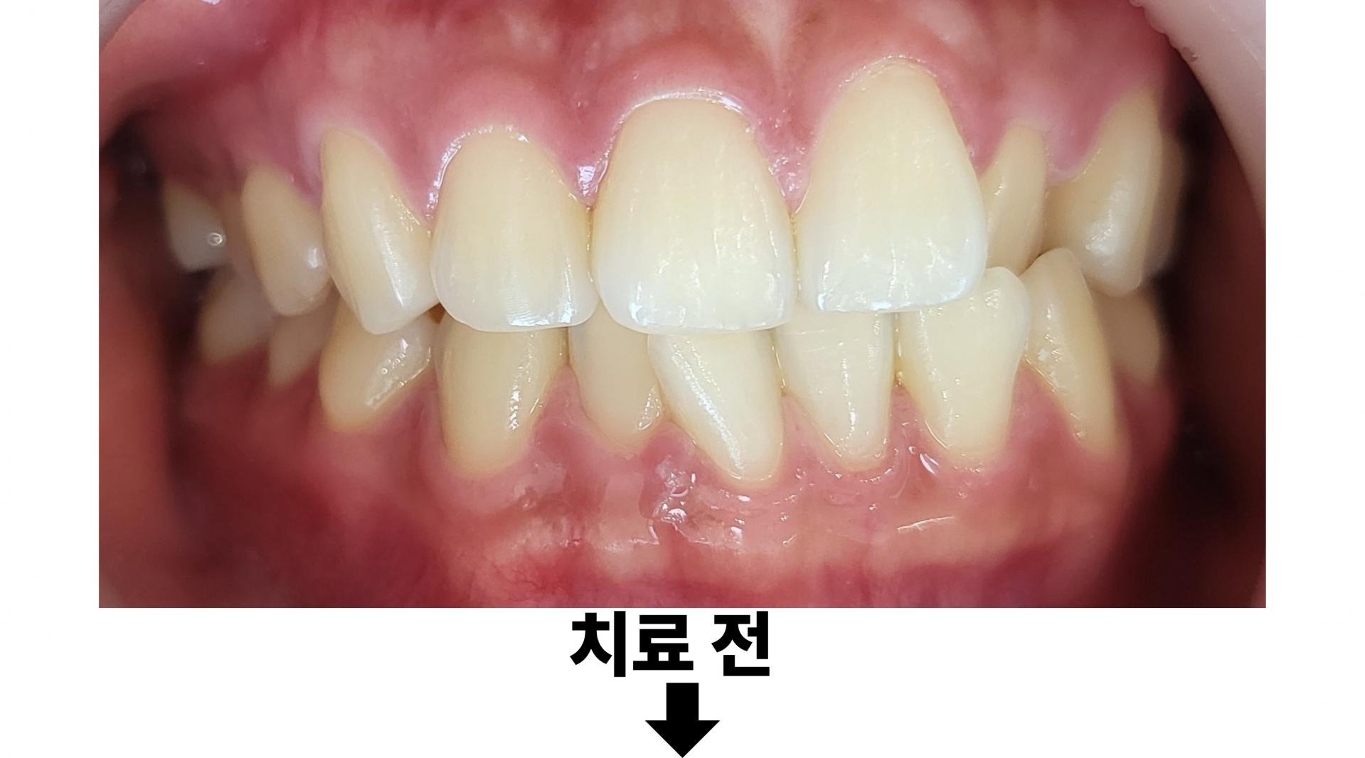 7ee10d3160721.jpg