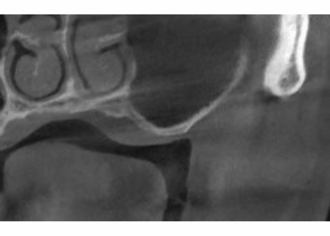 9e959839d97b4.gif