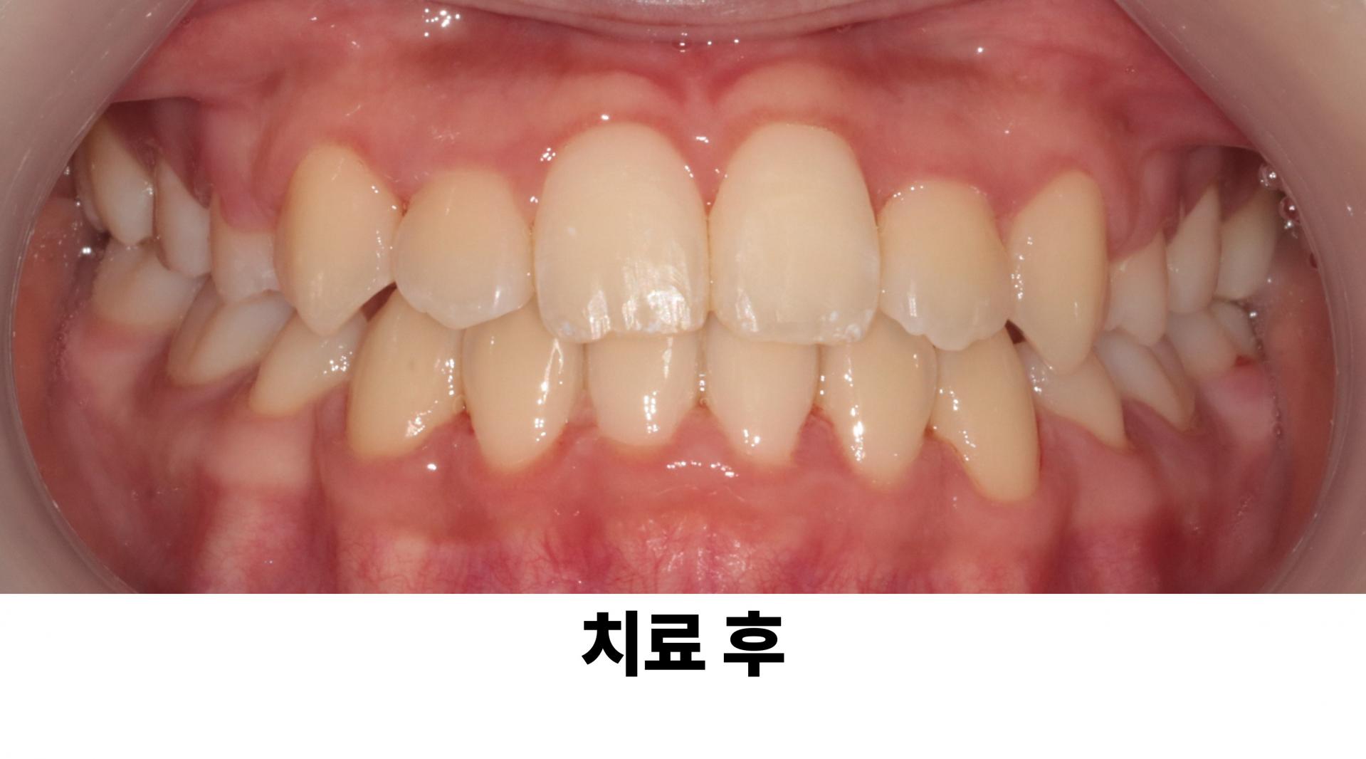 a35e2b5105a8d.jpg