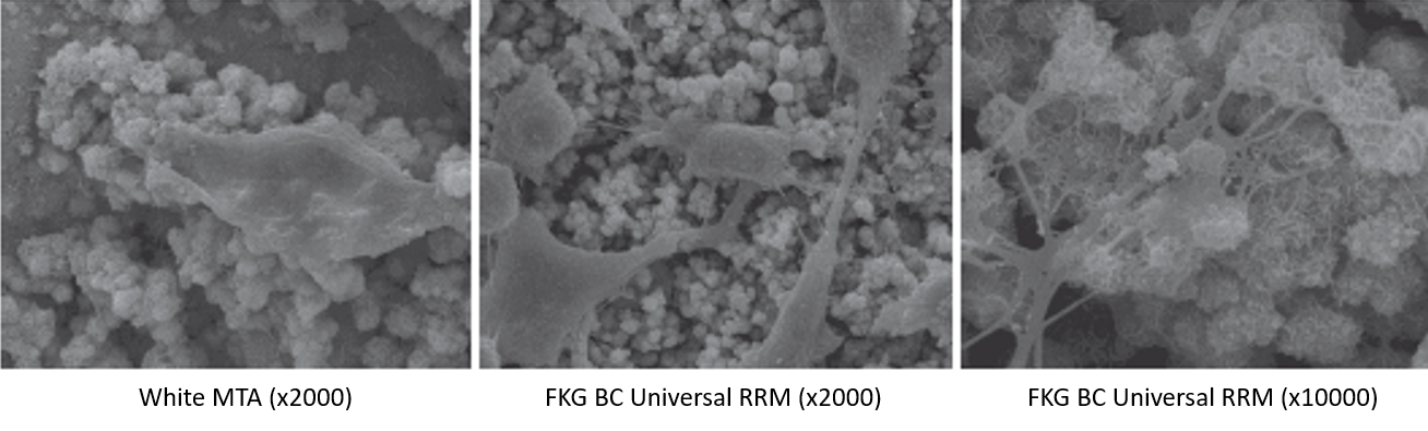 Rrm BC UNIVERSAL RRM (Putty) : 마이크로닉_FKG & Labomed