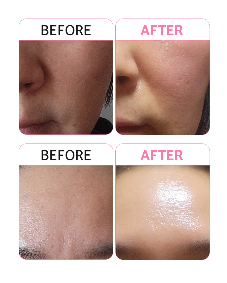 STRAWBERRY SOS INTENSIVE ANTI-AGING AMPOULE