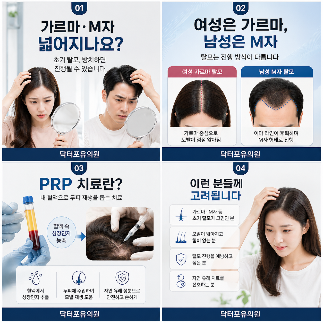 홍대탈모병원에서 가르마와 엠자 고민 환자들에게 PRP탈모치료설명