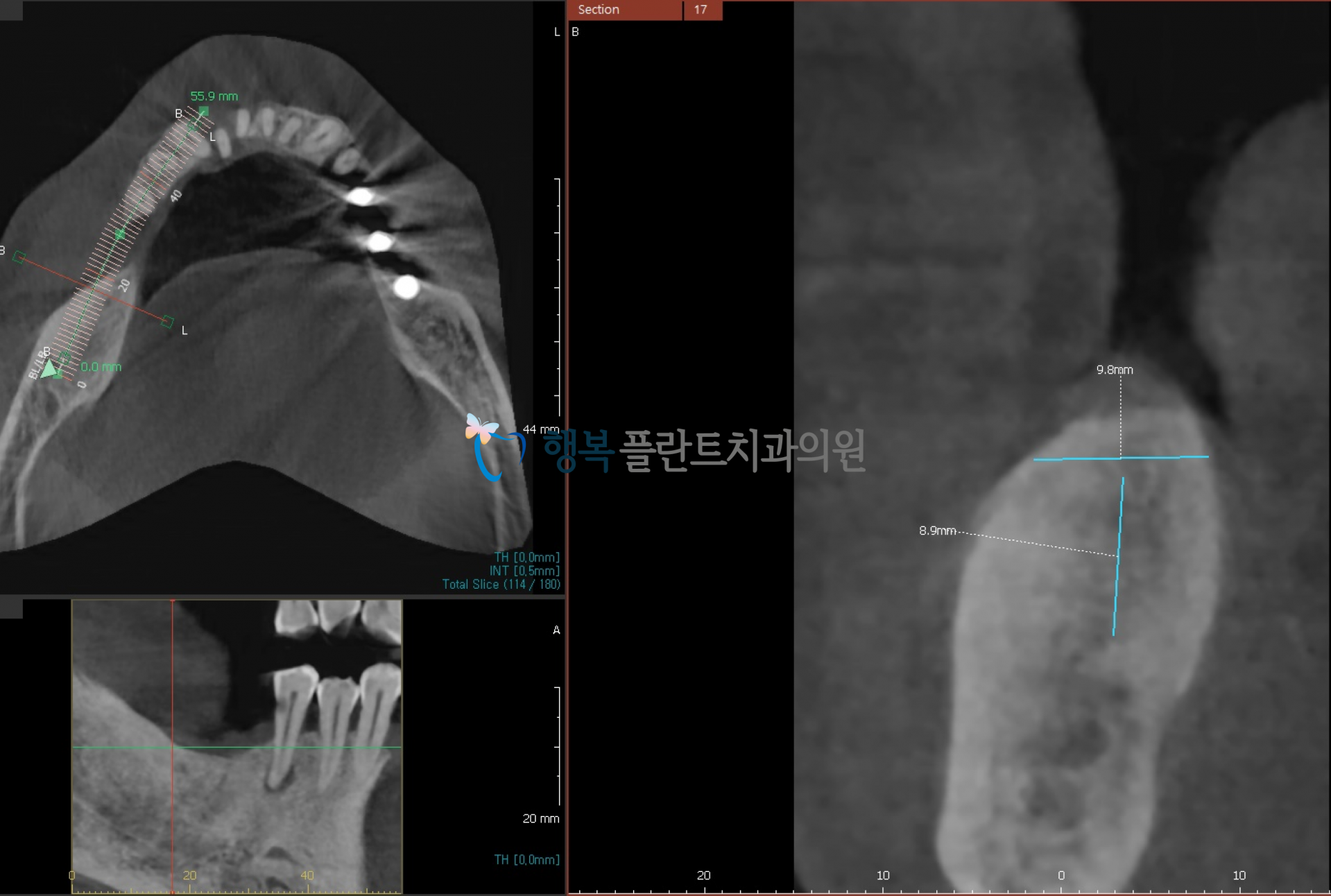 b6052afbaac6f.png