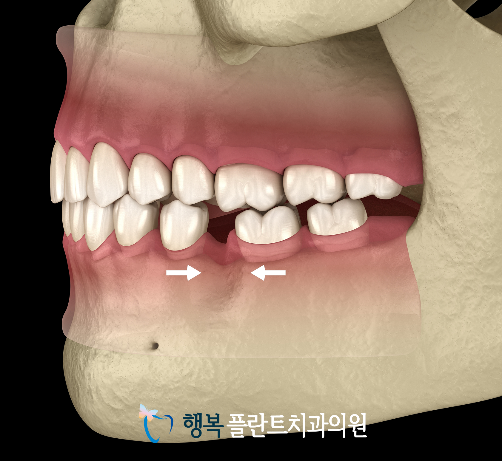 cccb7da522d2c.png