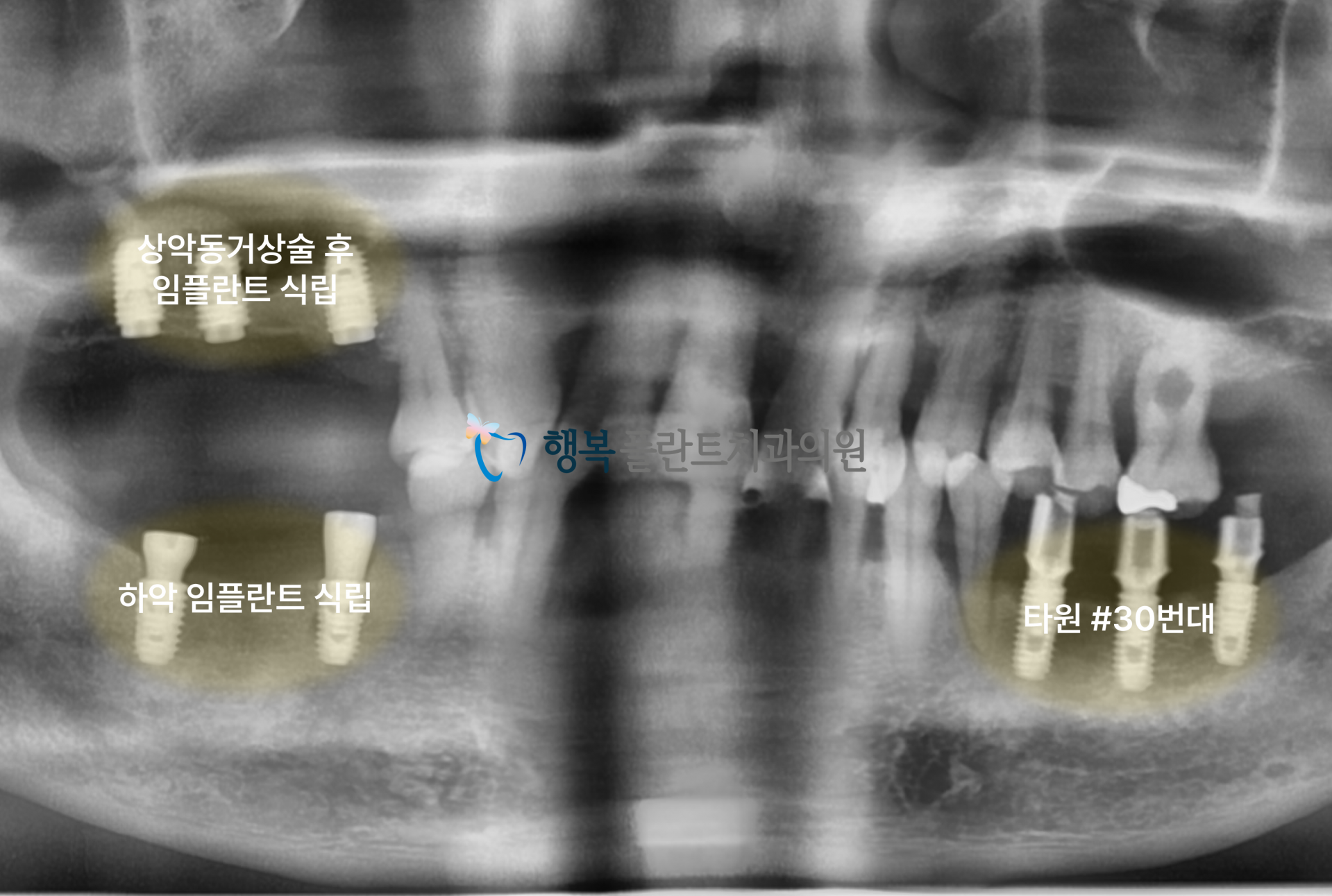 cd7cbcda49388.png