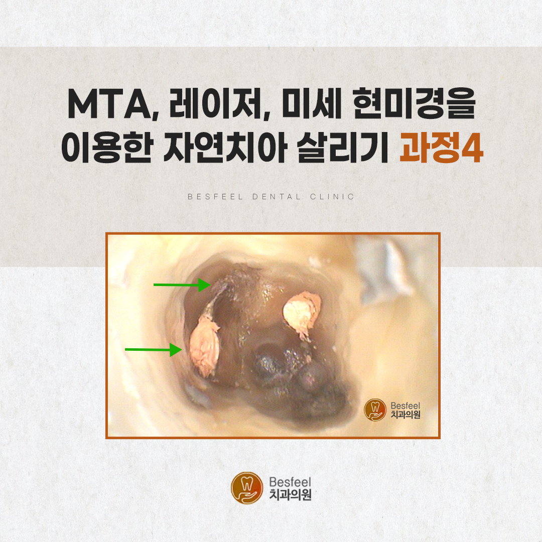93fc3b7fe615a.jpg