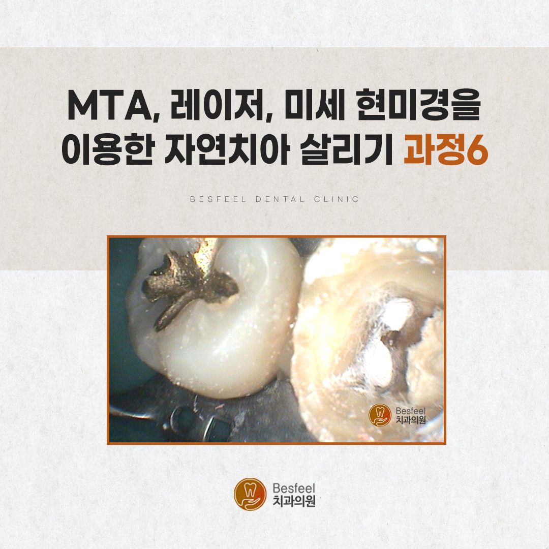 9e24b9371d1a2.jpg