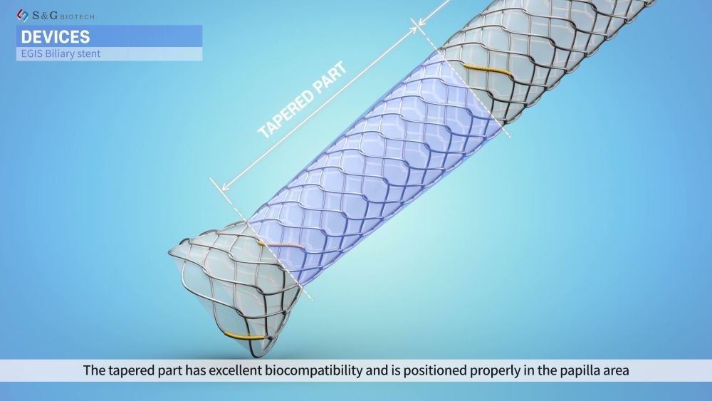 췌담관 스텐트와 전달 시스템의 구조를 지시선과 단면 회전, 분리·확대 연출로 설명한 의료 3D 이미지