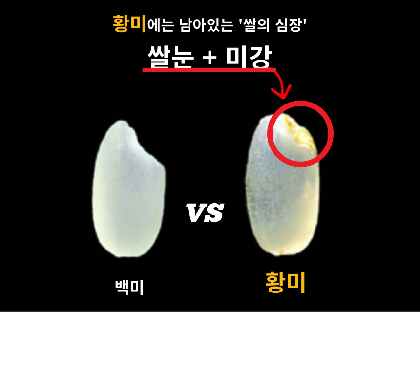 주진 상페