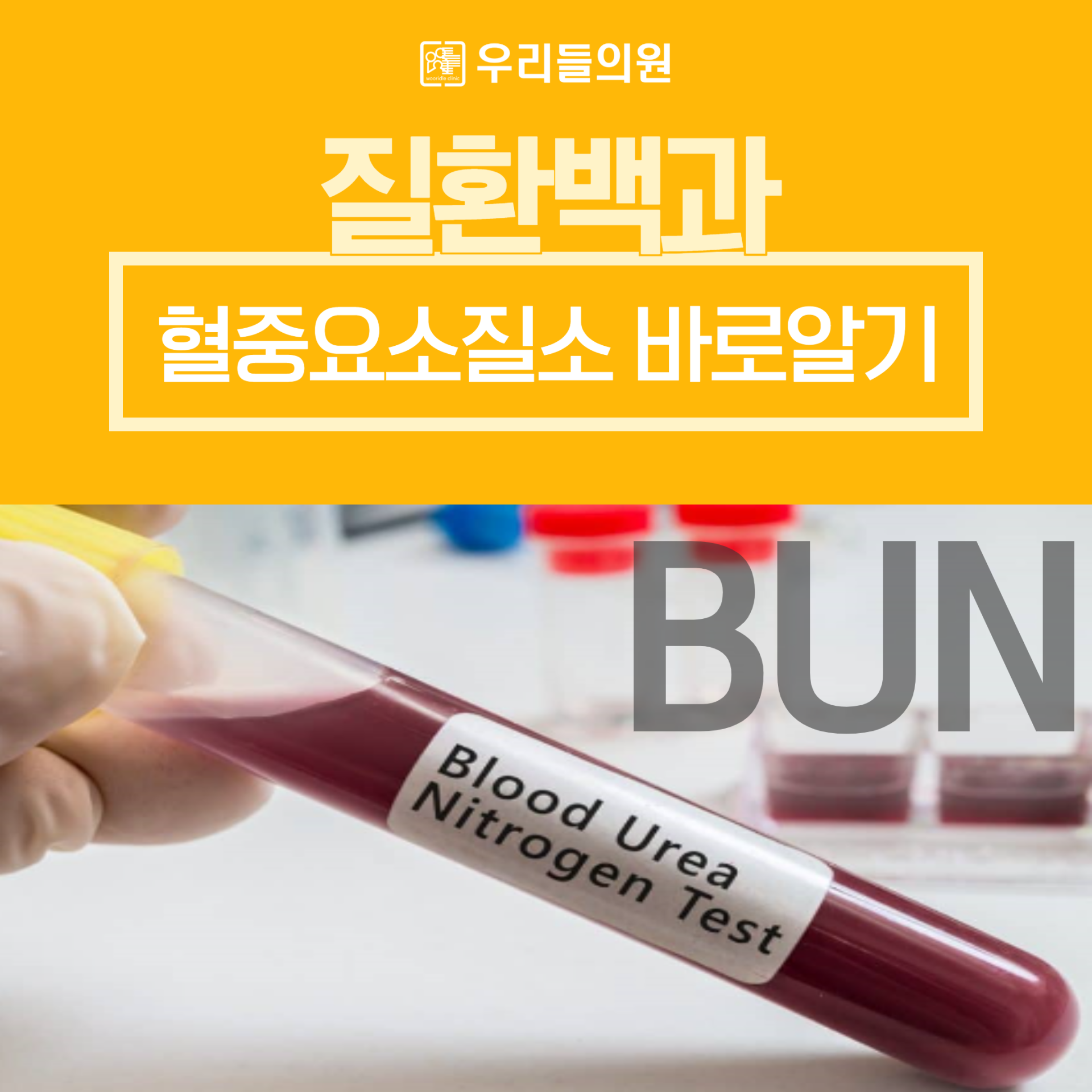 혈중요소질소