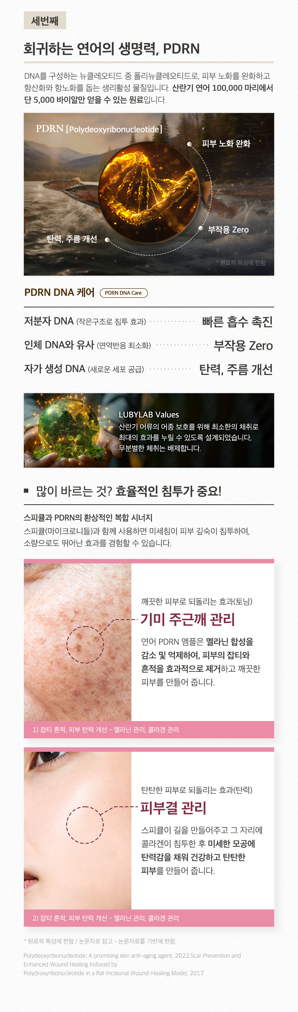 하이퍼 루비스피샷