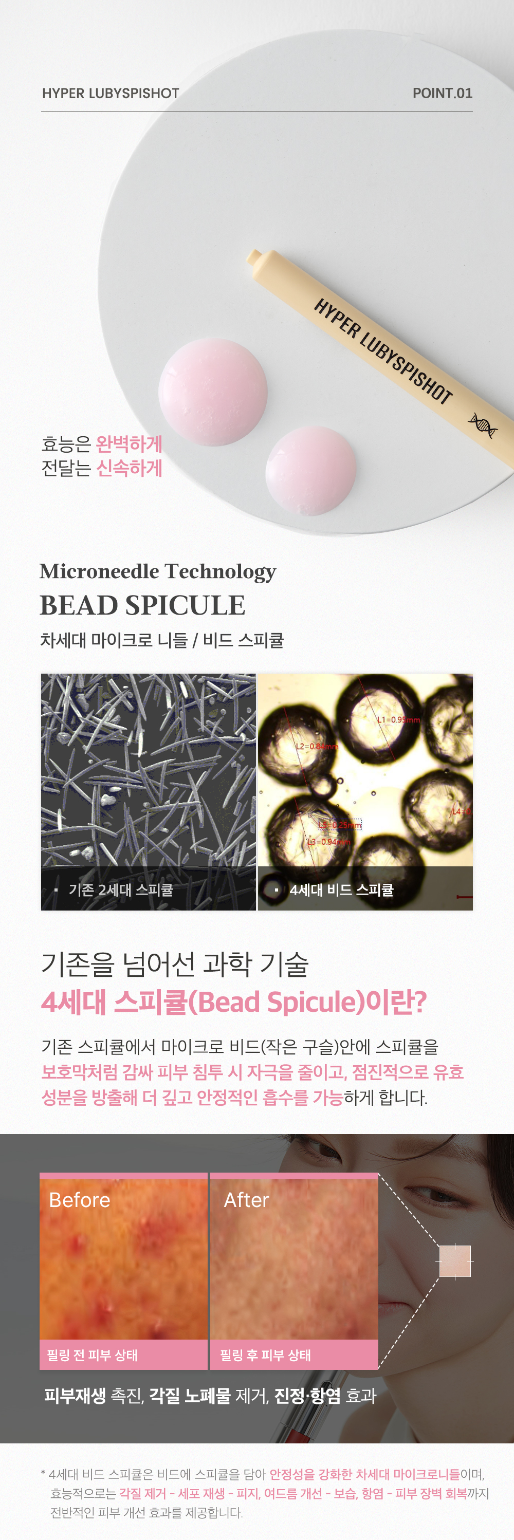하이퍼 루비스피샷