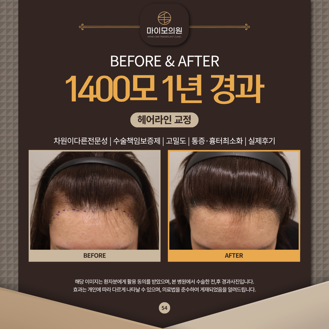 990daee294f6b.png