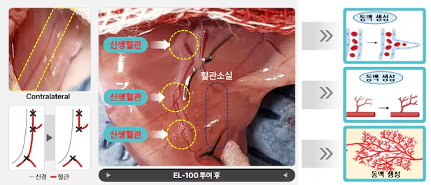 엘피스셀테라퓨틱스 중증하지허혈 치료 물질 'EL-100'의 동물실험 결과 그림. 혈류가 끊긴 쥐의 다리에 치료제를 투여하자, 썩어가던 조직에 새로운 혈관이 생기고 혈류와 혈류 속도가 개선됐다. 반면 치료제를 투여하지 않은 대조군은 다리 조직이 괴사해 절단했다./엘피스셀테라퓨틱스 