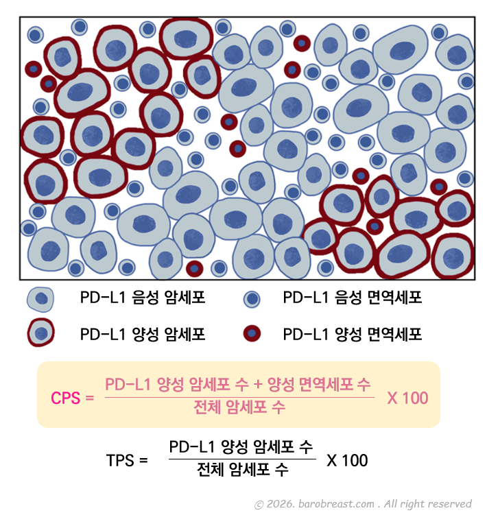 CPS 수치는 암세포 주변에서 면역반응이 얼마나 활발한지를 나타내는 점수로 병리과에서 슬라이드 제작 후 염색을 통해 알 수 있습니다. CPS 값은 PD-L1이 발현된 암세포와 면역세포를 모두 세고, 이를 전체 암세포 수로 나눠서 100을 곱한 값으로, 10 이상인 경우에 보험이 적용됩니다