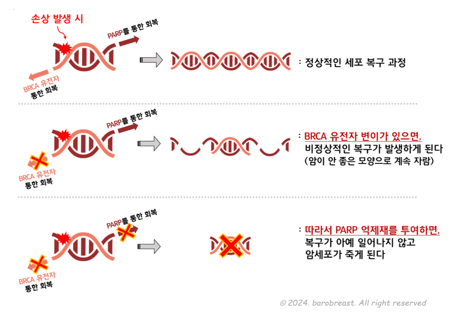 BRCA 유전자 손상이 있다면 유전자가 아예 회복을 못하게해서 세포를 죽여버리는 것이 PARP 억제제, 린파자 입니다.