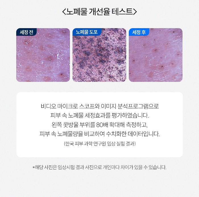 [잔수배출 프리미엄 SET] 슬로운 미스트샤워기 + 샤워호스