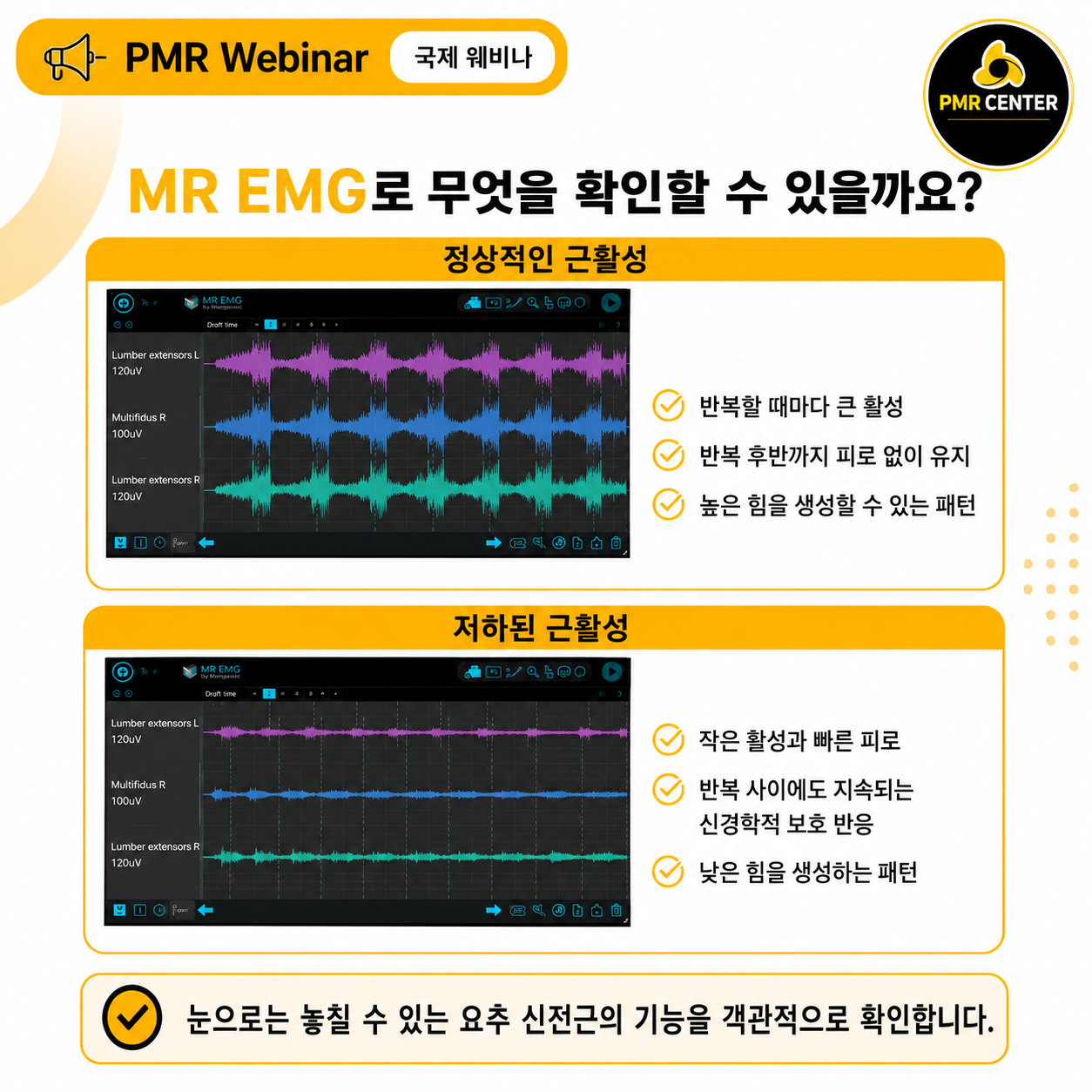 허리통증에서 표면근전도의 임상적
