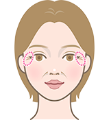 まぶたのたるみや小部位に効果的なリフテラの施術範囲を示す図
