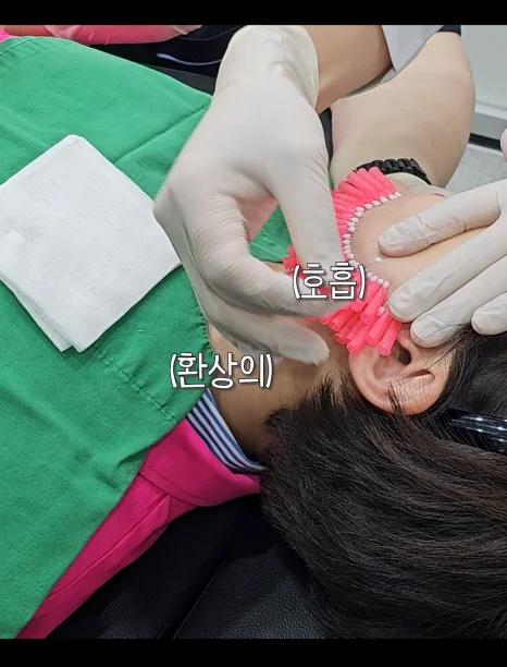 韓国 糸リフト施術中の糸挿入プロセス