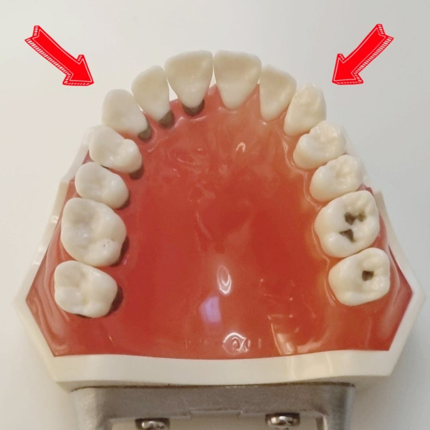 냉정역 송곳니 빠지는 시기와 올바른 관리 방법 : 치주과전문의 김성호 원장이 직접 전하는 덴탈 칼럼, image size:1664x1664