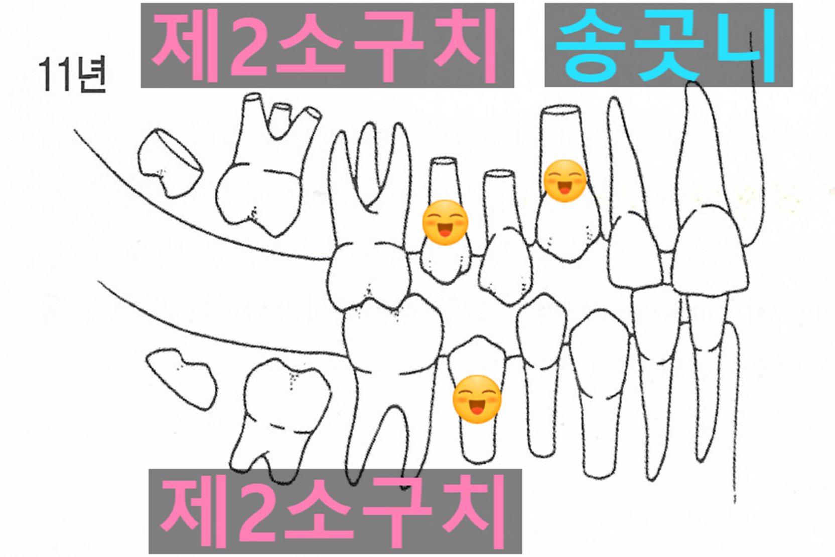 냉정역 송곳니 빠지는 시기와 올바른 관리 방법 : 치주과전문의 김성호 원장이 직접 전하는 덴탈 칼럼, image size:1664x1109